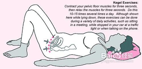 凯格尔运动的锻炼方法