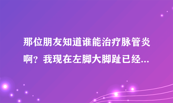 那位朋友知道谁能治疗脉管炎啊？我现在左脚大脚趾已经溃烂了，疼得要命啊！！求好心人告诉我那能治疗脉管