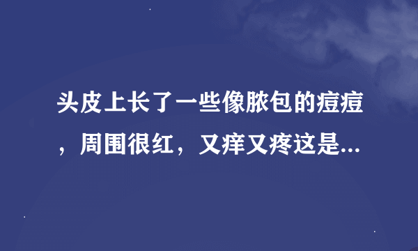 头皮上长了一些像脓包的痘痘，周围很红，又痒又疼这是什么病？