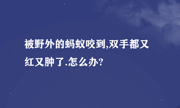 被野外的蚂蚁咬到,双手都又红又肿了.怎么办?