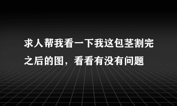 求人帮我看一下我这包茎割完之后的图，看看有没有问题