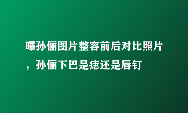 曝孙俪图片整容前后对比照片，孙俪下巴是痣还是唇钉