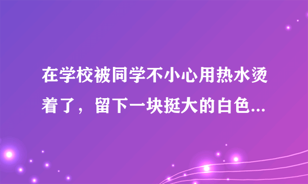 在学校被同学不小心用热水烫着了，留下一块挺大的白色疤痕，因为那个同学是因为打架弄倒水壶的，所以学校