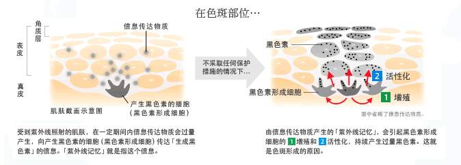 怎样可以淡化脸上的斑？能彻底消除么？