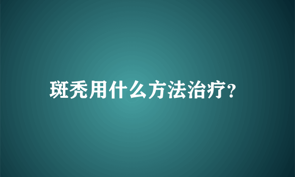 斑秃用什么方法治疗？