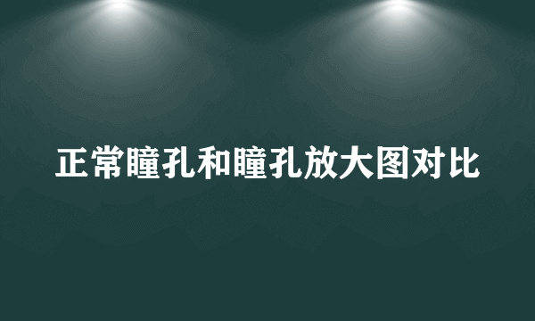 正常瞳孔和瞳孔放大图对比