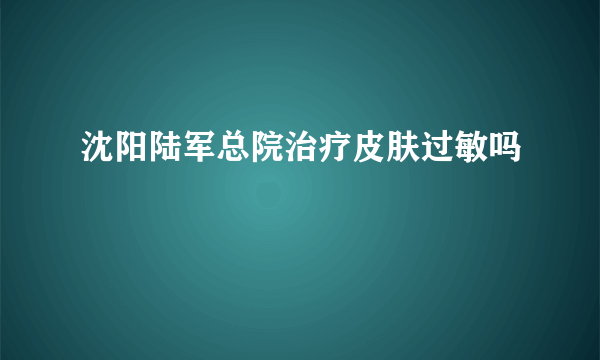 沈阳陆军总院治疗皮肤过敏吗