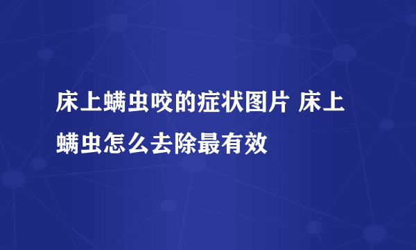 床上螨虫咬的症状图片 床上螨虫怎么去除最有效