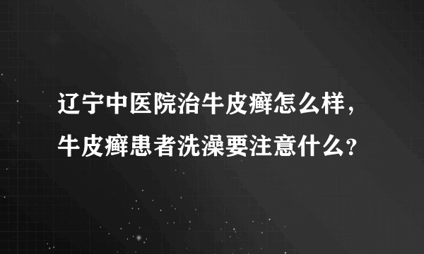 辽宁中医院治牛皮癣怎么样，牛皮癣患者洗澡要注意什么？