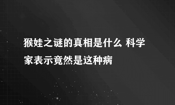 猴娃之谜的真相是什么 科学家表示竟然是这种病 