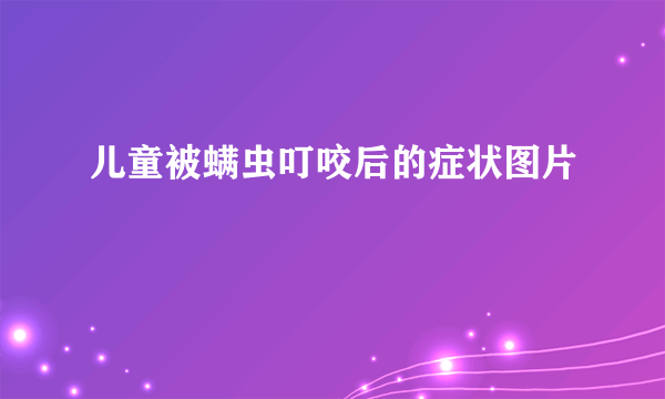 儿童被螨虫叮咬后的症状图片