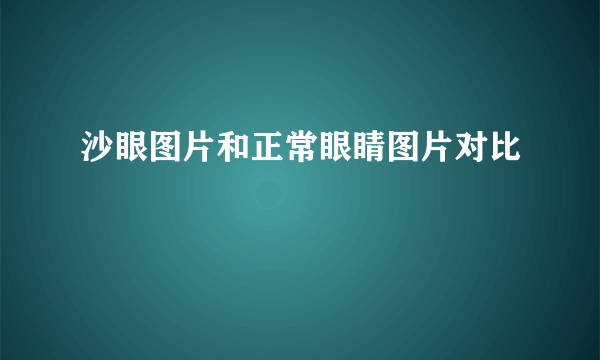 沙眼图片和正常眼睛图片对比