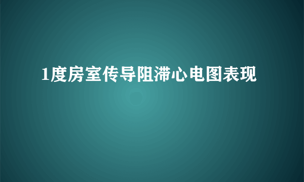 1度房室传导阻滞心电图表现