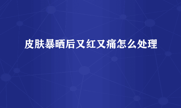 皮肤暴晒后又红又痛怎么处理