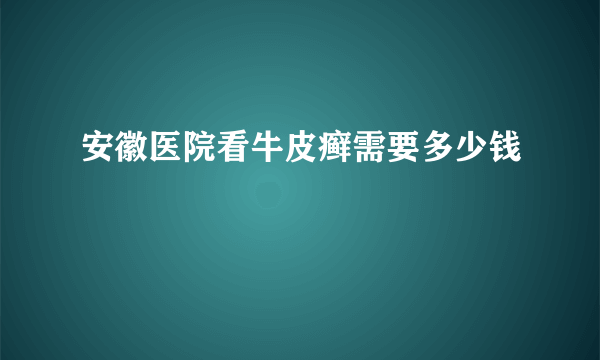 安徽医院看牛皮癣需要多少钱