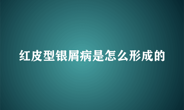 红皮型银屑病是怎么形成的