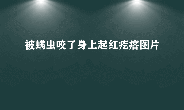 被螨虫咬了身上起红疙瘩图片