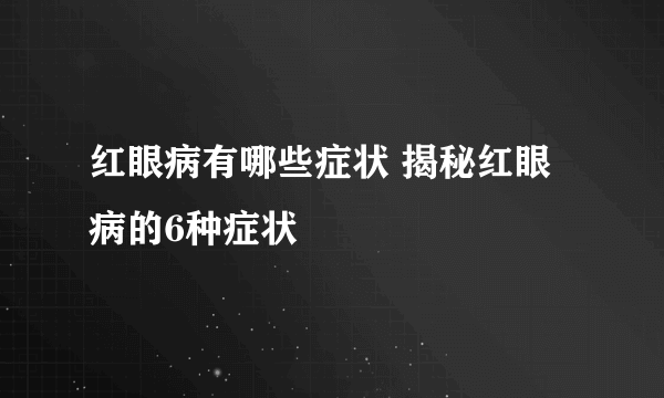 红眼病有哪些症状 揭秘红眼病的6种症状