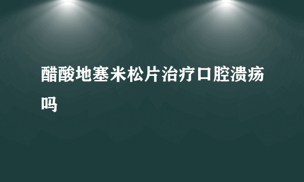 醋酸地塞米松片治疗口腔溃疡吗