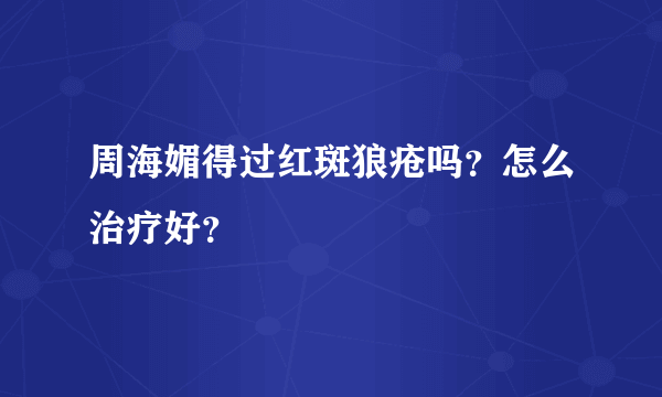 周海媚得过红斑狼疮吗？怎么治疗好？