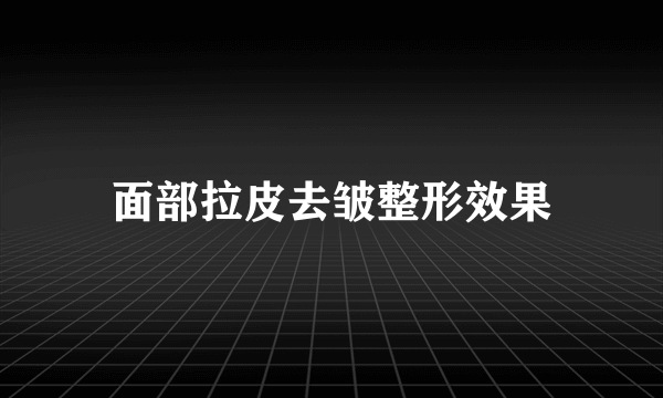 面部拉皮去皱整形效果