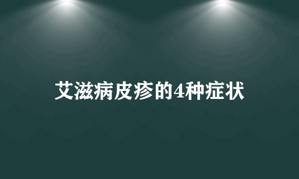 艾滋病皮疹的4种症状