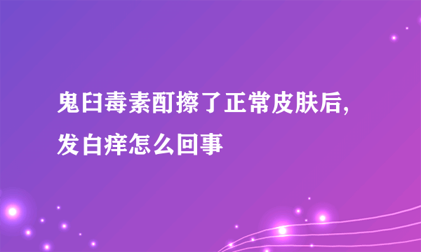 鬼臼毒素酊擦了正常皮肤后,发白痒怎么回事