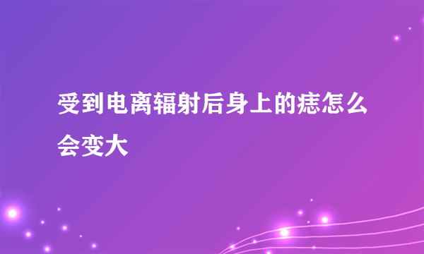 受到电离辐射后身上的痣怎么会变大