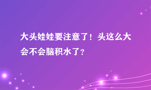 大头娃娃要注意了！头这么大会不会脑积水了？