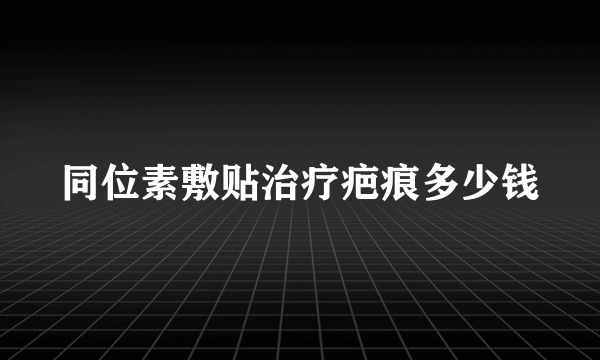 同位素敷贴治疗疤痕多少钱