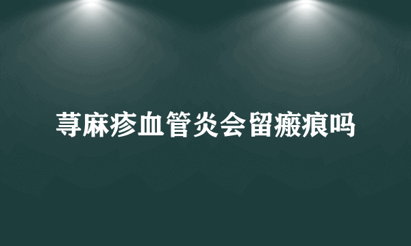 荨麻疹血管炎会留瘢痕吗