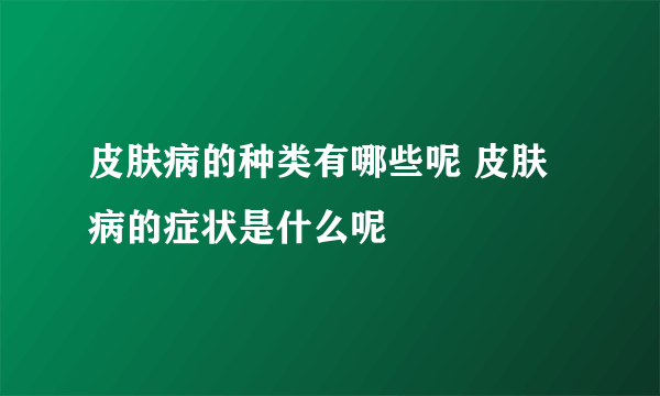 皮肤病的种类有哪些呢 皮肤病的症状是什么呢