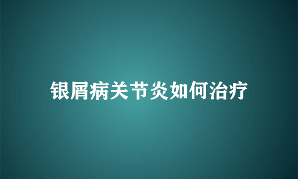 银屑病关节炎如何治疗