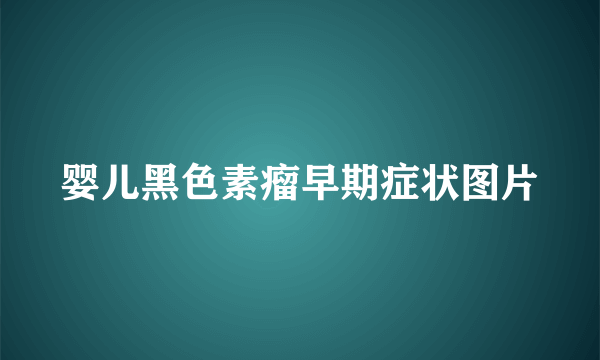 婴儿黑色素瘤早期症状图片