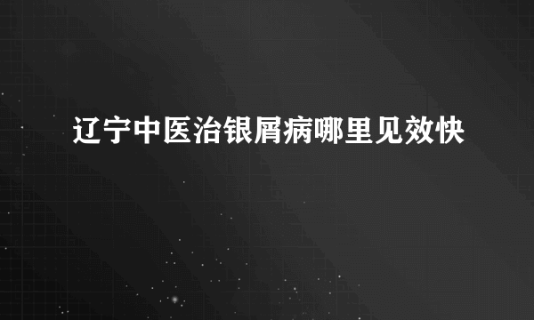 辽宁中医治银屑病哪里见效快