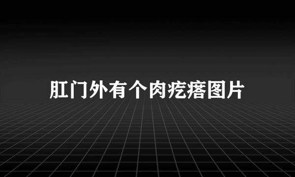 肛门外有个肉疙瘩图片