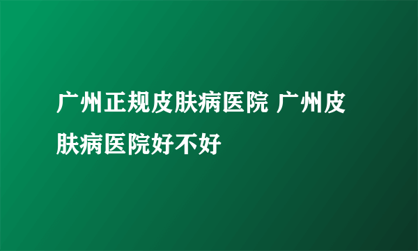 广州正规皮肤病医院 广州皮肤病医院好不好