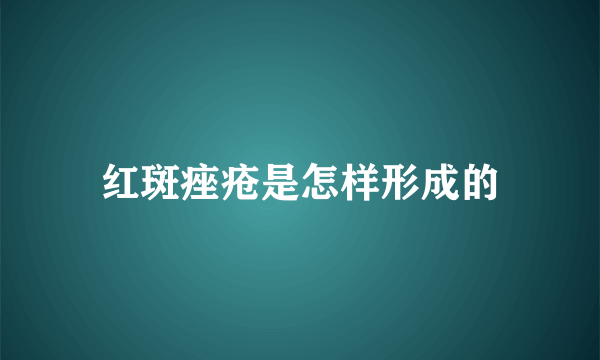 红斑痤疮是怎样形成的