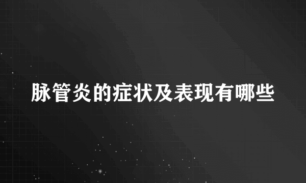 脉管炎的症状及表现有哪些