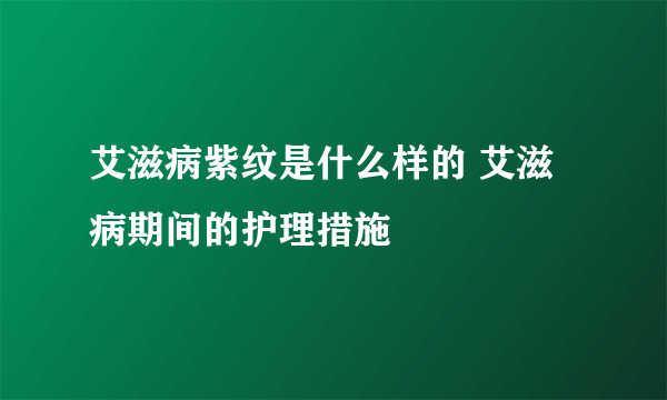 艾滋病紫纹是什么样的 艾滋病期间的护理措施