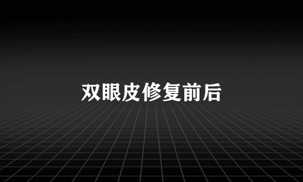 双眼皮修复前后