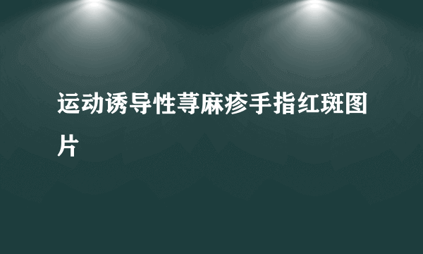 运动诱导性荨麻疹手指红斑图片