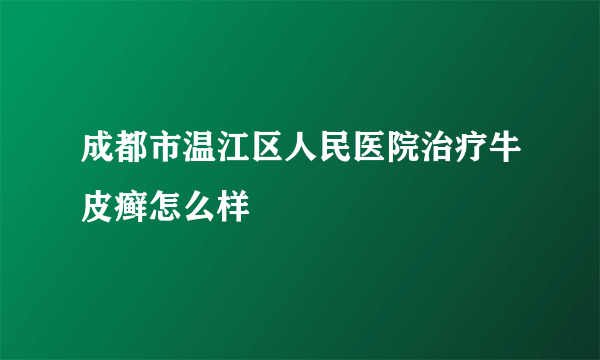 成都市温江区人民医院治疗牛皮癣怎么样