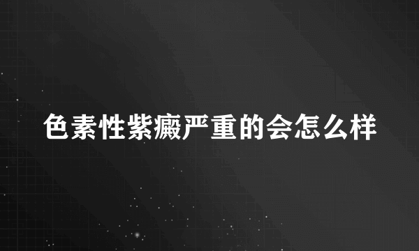 色素性紫癜严重的会怎么样