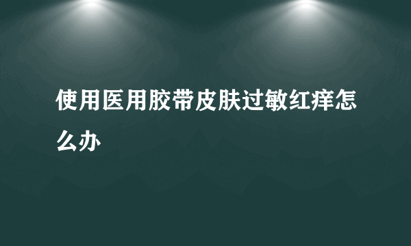 使用医用胶带皮肤过敏红痒怎么办