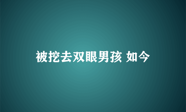 被挖去双眼男孩 如今