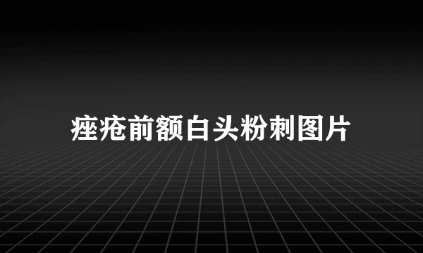 痤疮前额白头粉刺图片