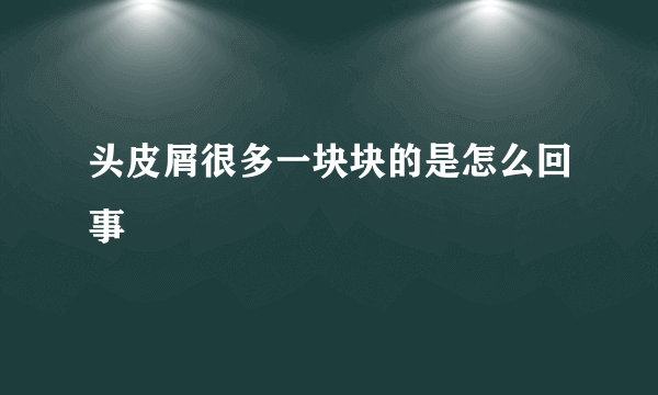 头皮屑很多一块块的是怎么回事