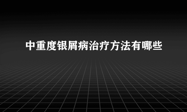 中重度银屑病治疗方法有哪些