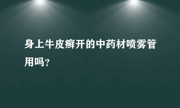 身上牛皮癣开的中药材喷雾管用吗？